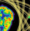 Neuroimaging PET scan of a human brain